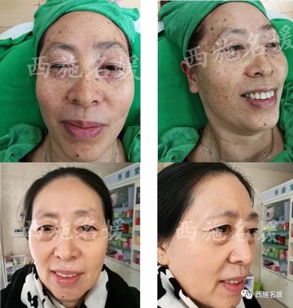 父親節(jié)丨這次換我來守護(hù)爸爸的青春了！