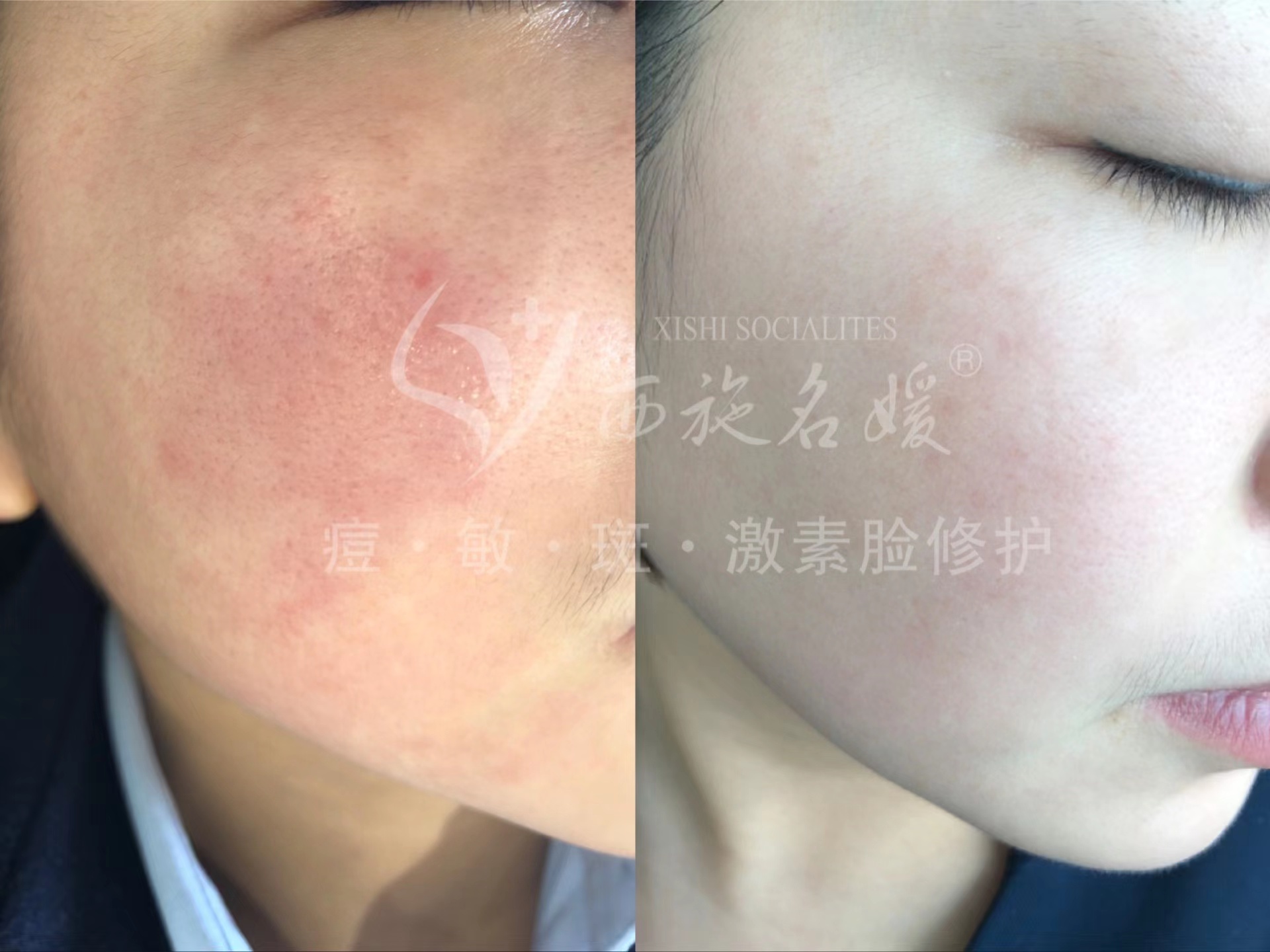 爆品丨西施名媛藍(lán)銅肽安膚套、纖雅源積雪草舒潤(rùn)套