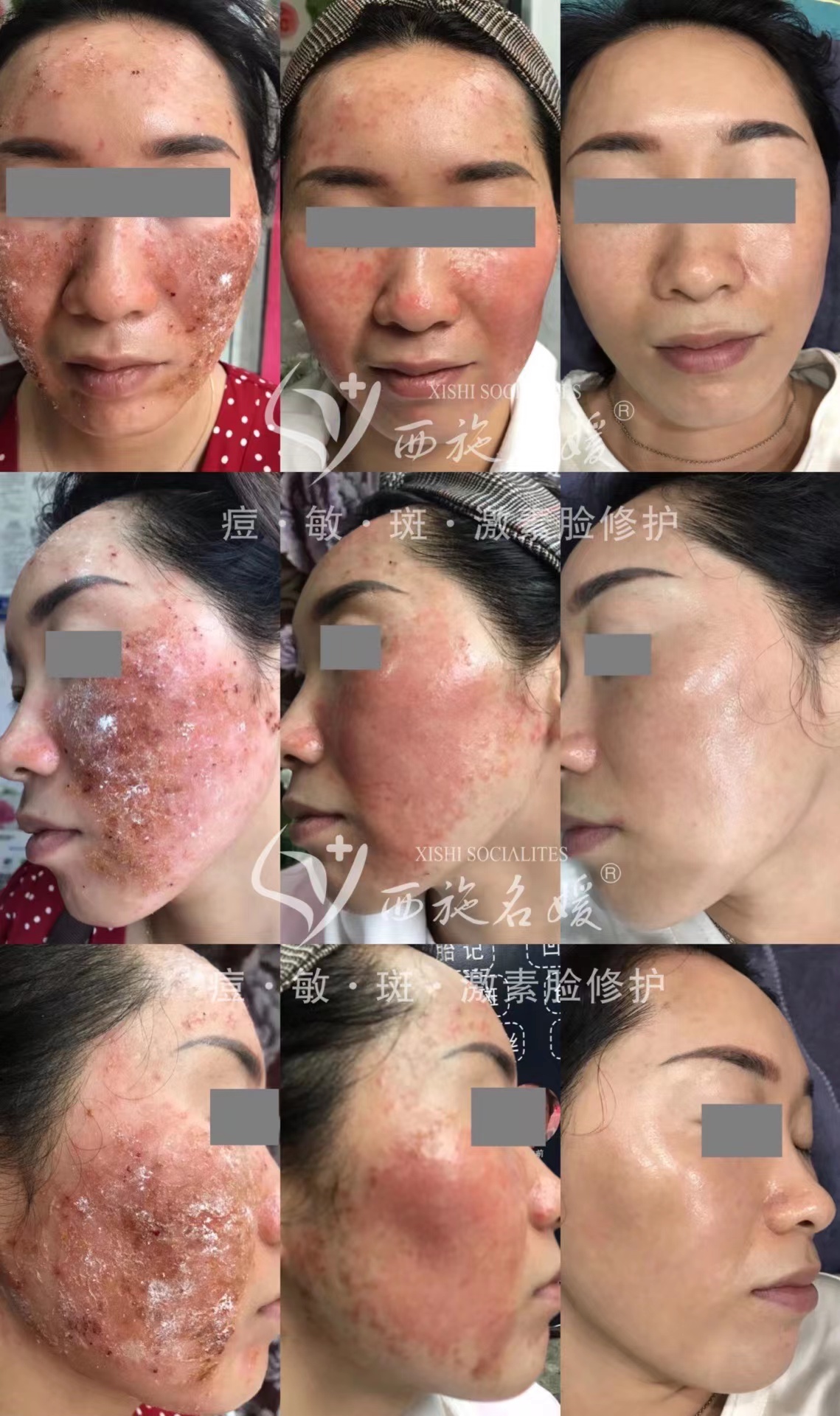 爆品丨西施名媛藍(lán)銅肽安膚套、纖雅源積雪草舒潤(rùn)套